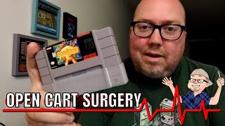 Open Cart Surgery - Earthbound for SNES