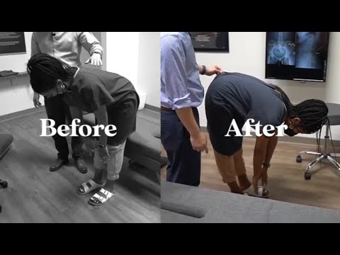 Sciatica video 1 – thumbnail