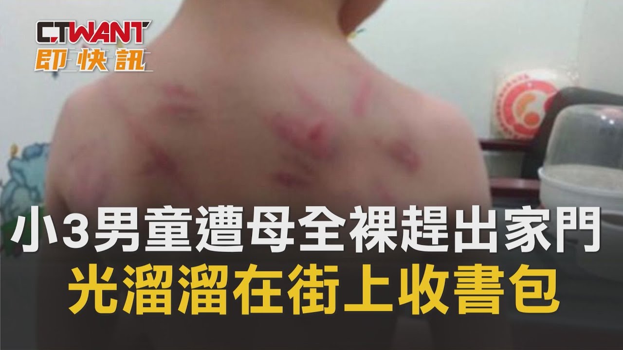 圖說-小3男童遭母全裸趕出家門　光溜溜在街上收書包