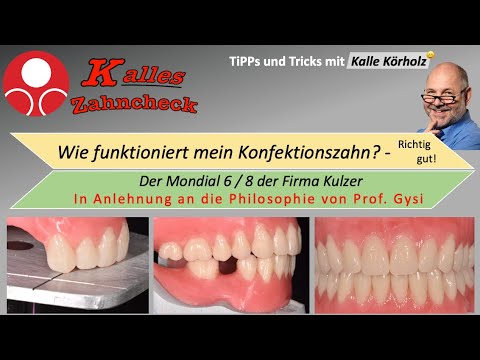 Kalles Zahncheck- Die Aufstellung der Mondial Zähne nach der Philosophie von Prof.A. Gysi