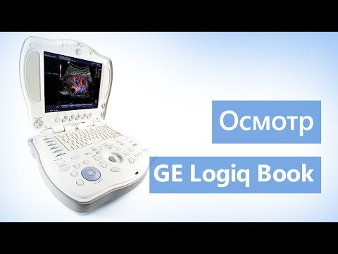 Отек в суставе при ушибе руки Присед со штангой при остеохондрозе