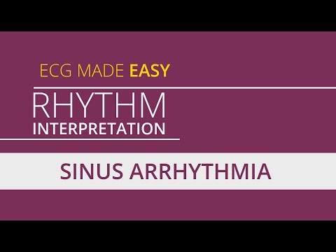 Sinus Arrhythmia | Learn ECG Rhythm