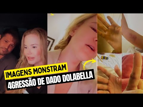 Controversy: Images of Marcela Tomaszewski after a fight with Dado Dolabella shock the web!
