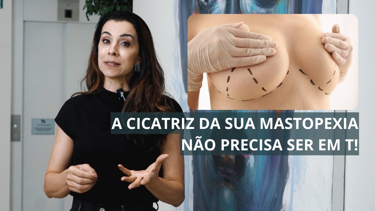 A CICATRIZ DA SUA MASTOPEXIA NÃO PRECISA SER UM PROBLEMA!