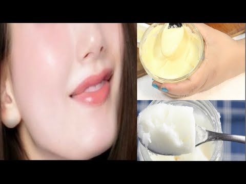 How To Remove Blackheads Instantly Video