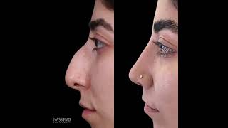 NassifMD Plastic Surgery
