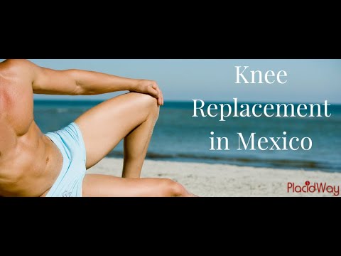 Watch Knee Replacement in Mexico