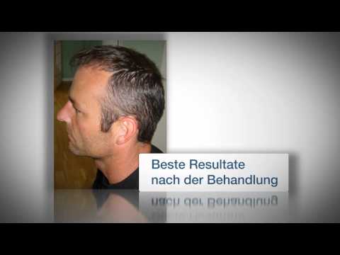 download lagu mp3 mp4 Medizinische Kosmetik Bern, download lagu Medizinische Kosmetik Bern gratis, unduh video klip Medizinische Kosmetik Bern