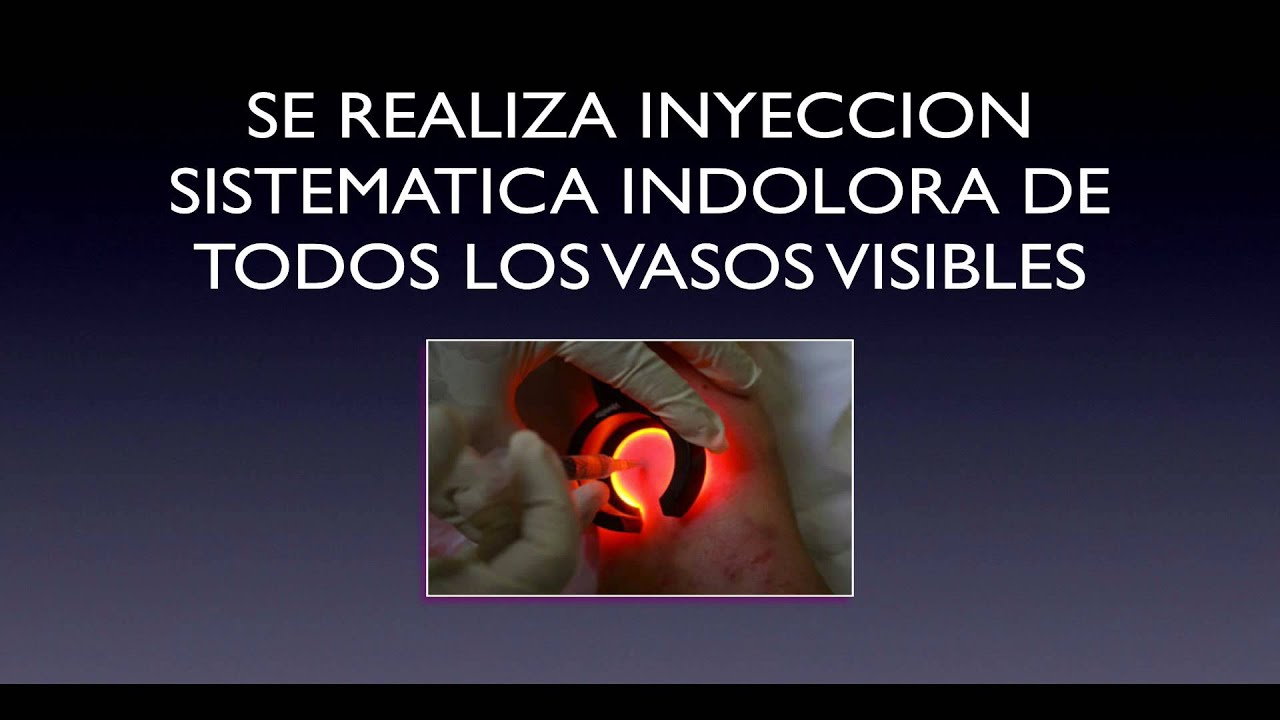 Abraham Moises Barbero Gonzalez-25