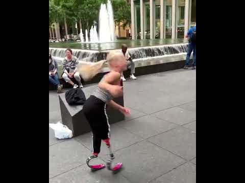 Girl With Prosthetic Legs Does Cartwheels - 1143130
