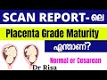 Placenta Grade in Scan Report Malayalam | Placenta Position