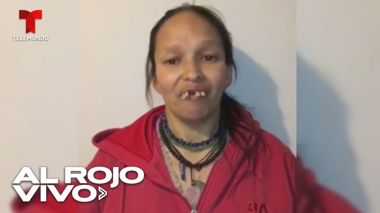 Una mujer recibe una transformación radical de su sonrisa en Colombia