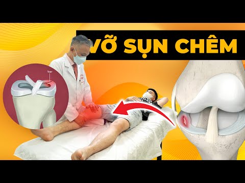 Gối Bị Kẹt Không Duỗi Được - Nỗi Ác Mộng Của Sụn Chêm Rách