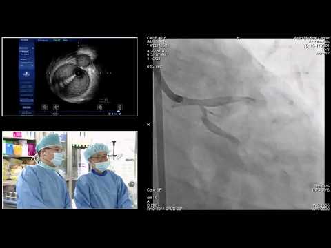 [TCTAP 2019] Main Session - Live Case Session II