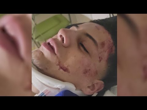 Tensions flare after viral video shows Oak Lawn cops punching teen suspect