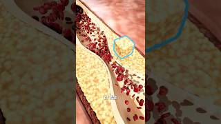 Download lagu The Biology Of A Heart Attack 🫀 Surgeon Reacts mp3