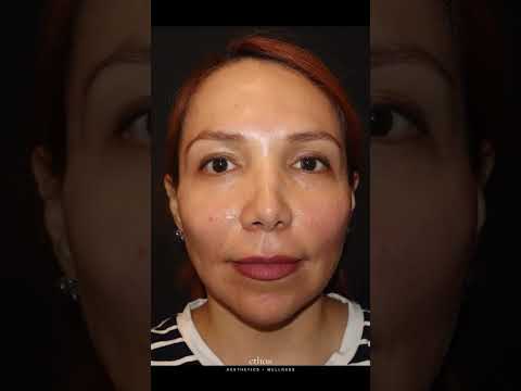 Facial Balancing