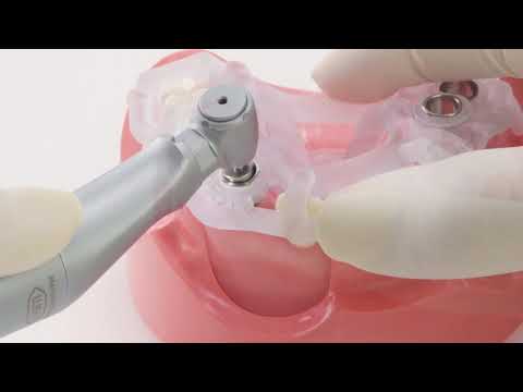How place a dental implant using the MIS MGUIDE surgical template