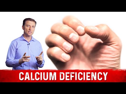 Calcium and Magnesium Absorption Basics – Dr Berg