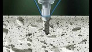 SonicWeld Rx® | Endobrow fixation