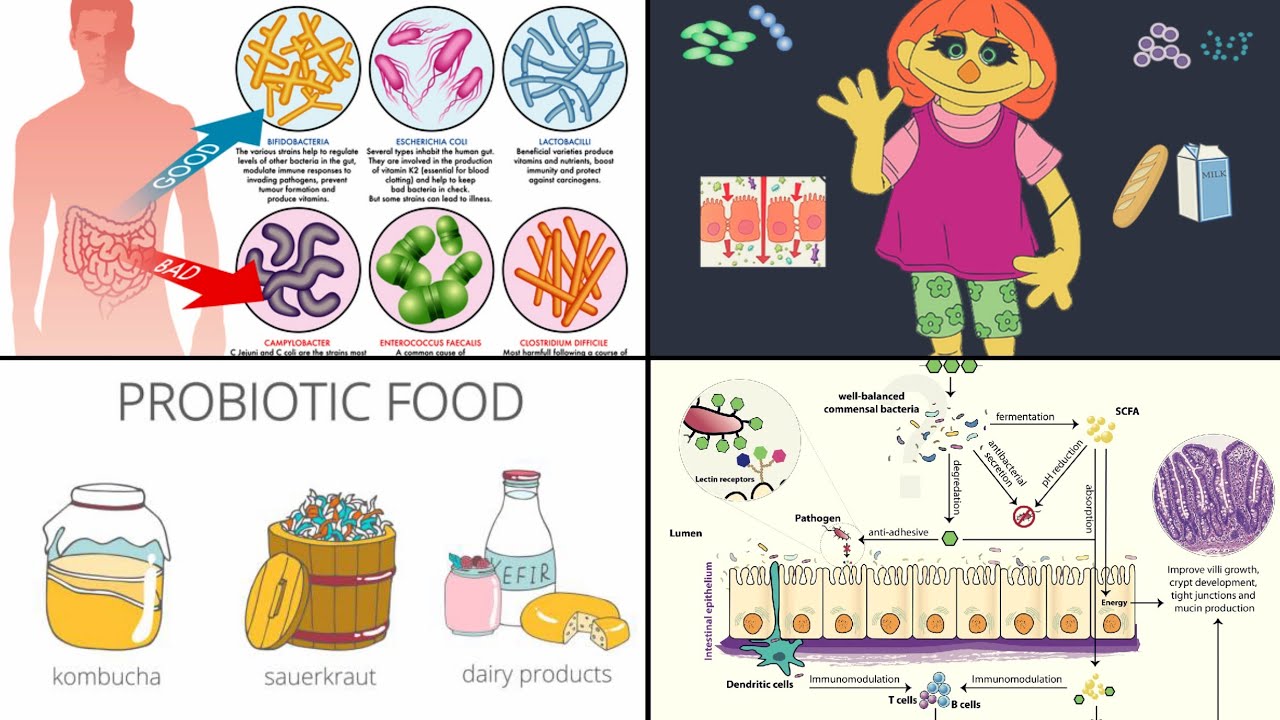 Treatments and Therapies for Gut Microbiomes for Autistic Patients Part 2