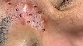 دوافع التنظيف والتجميل #𝐁𝐥𝐚𝐜𝐤𝐡𝐞𝐚𝐝 𝐑𝐞𝐦𝐨𝐯𝐞 8630