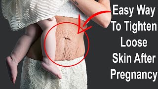How to Tighten Loose Skin After Pregnancy