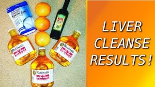 My Liver & Gallbladder Cleanse Experience from Andreas Moritz