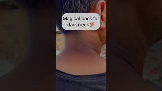Remove neck darkness in 10 mins😱💯 #shorts #beautytips #skincare #viral #homeremedies #youtube
