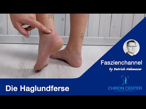 Where does the pain in the Achilles tendon and heel come from, Haglund's heel. What can you do?