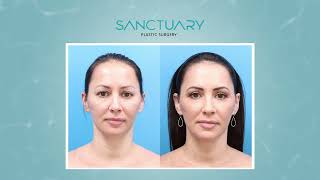 Sanctuary Plastic Surgery
