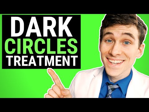 How to Get Rid of Dark Circles - 7 Pro Tips and Natural Remedies Video