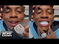 Soulja Boy Goes In On Charleston White Says He Cant Afford A Cartier Watch Or Even White Teeth