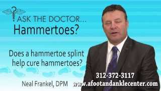 preview picture of video 'Does A Hammertoe Splint Help Cure Hammertoes? Chicago, Oak Brook, Lincolnwood, IL - Podiatrist'