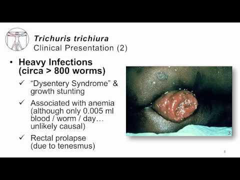 Pinworm tünetek hőmérséklet