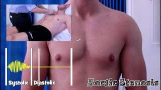 Heart Murmurs for Beginners