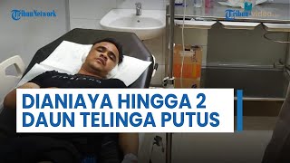Warga Banda Aceh Dianiaya hingga 2 Daun Telinganya Putus, Diduga Gara-gara Masalah Utang Piutang