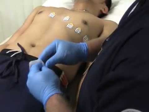Showing Performing of Resting ECG