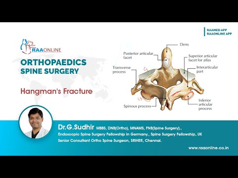 Hangman's Fracture