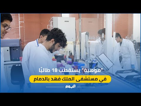 شاهد.. "موهبة" يستقطب 18 طالبًا في مستشفى الملك فهد بالدمام