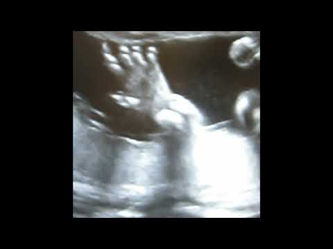 Planet Uterus - Life