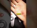 Mario Party INJURED Gamers Supermario Nintendo Videogames N64 Nintendoswitch