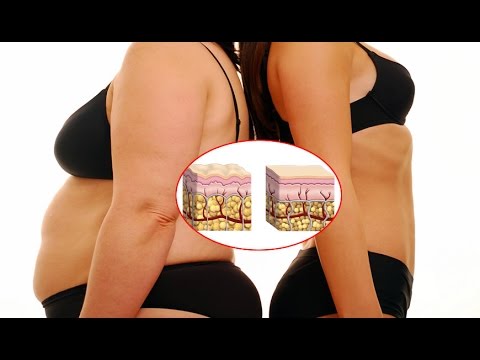 NLP del practician per perdita di peso Latti cagliati contenti calorici a perdita di peso