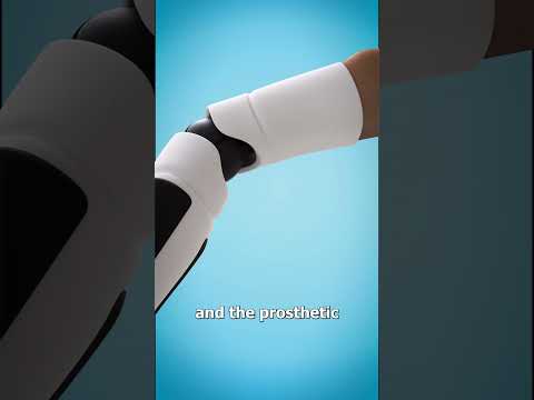 How A Bionic Arm Works ????