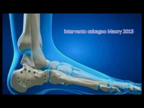 ICD-10 codice osteocondrosi cervicale Mal di schiena dopo il lavoro al cottage