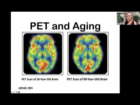 Positive Approach to Dementia Care Series #1: Normal vs Not Normal Aging