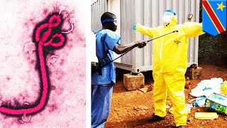 Ebola outbreak in Congo now second deadliest in history - TomoNews