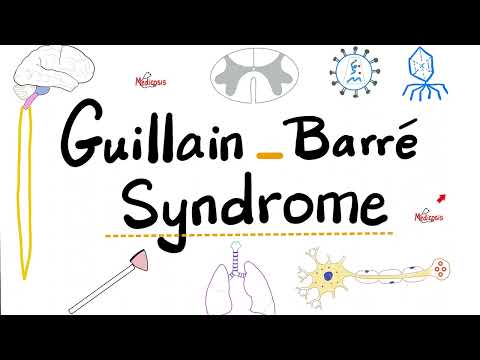 Guillain-Barré Syndrome - Acute Inflammatory Demyelinating Polyradiculoneuropathy “AIDP”- Neurology