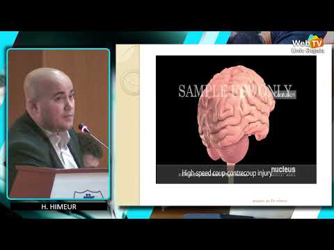 Prise en charge du traumatisme cranien grave. Actualités et tendances.H. HIMEUR, H. BEKRALAS