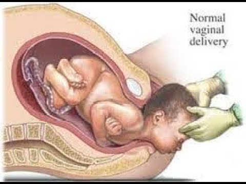 Patogen perempuan ulasan pelanggan Crestor dan impotensi